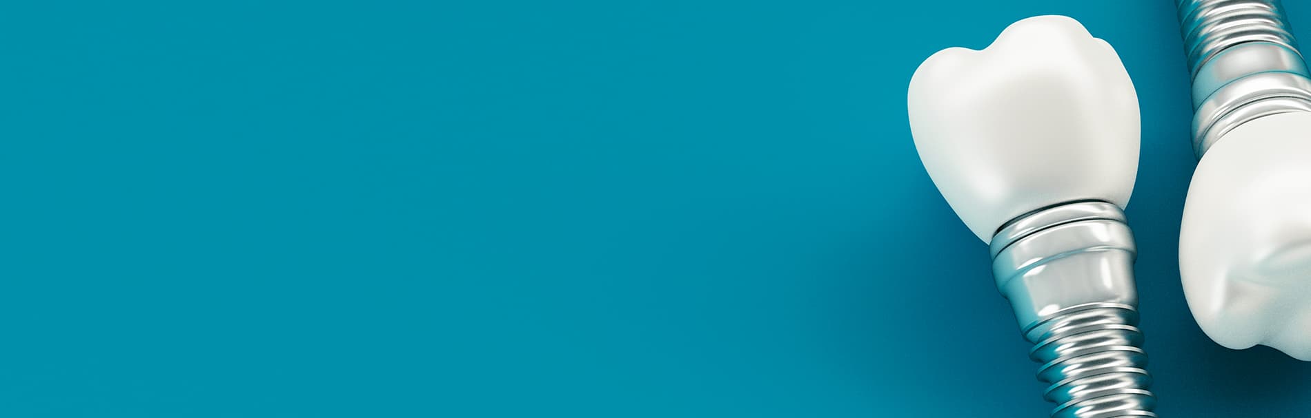 Implantologie behandeling